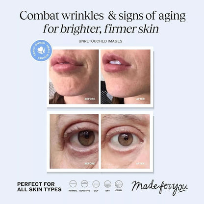 Advanced Retinol & Hyaluronic Acid Renewal Cream – Buy 1 Get 1 Free