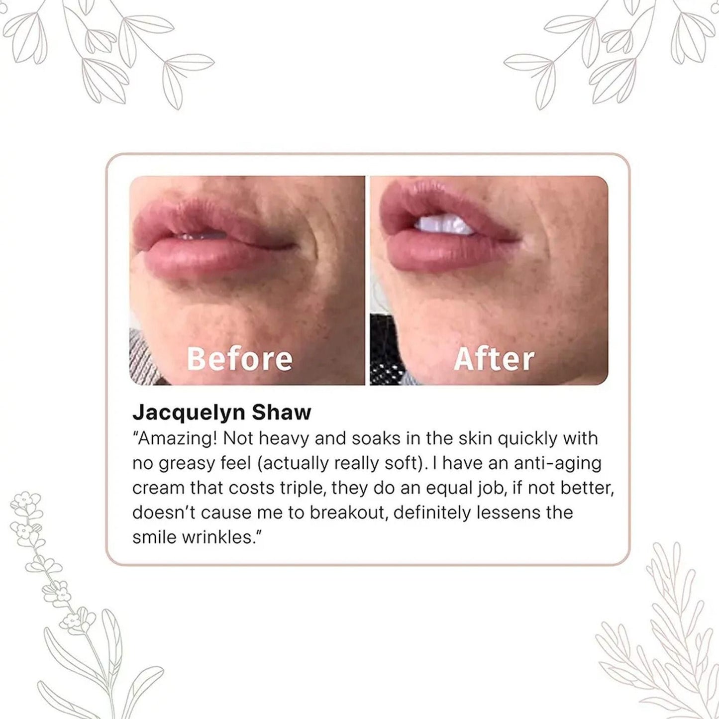 Advanced Retinol & Hyaluronic Acid Renewal Cream – Buy 1 Get 1 Free