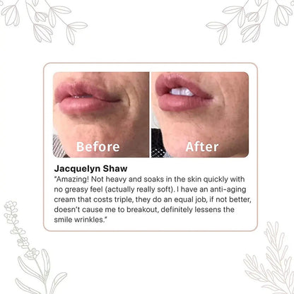 Advanced Retinol & Hyaluronic Acid Renewal Cream – Buy 1 Get 1 Free